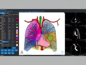 خدمات بازسازی پزشکی سه بعدی و چاپ سه بعدی